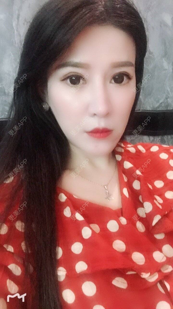 更美 - 甘思佳的热玛吉经验 | 北京 | 热玛吉