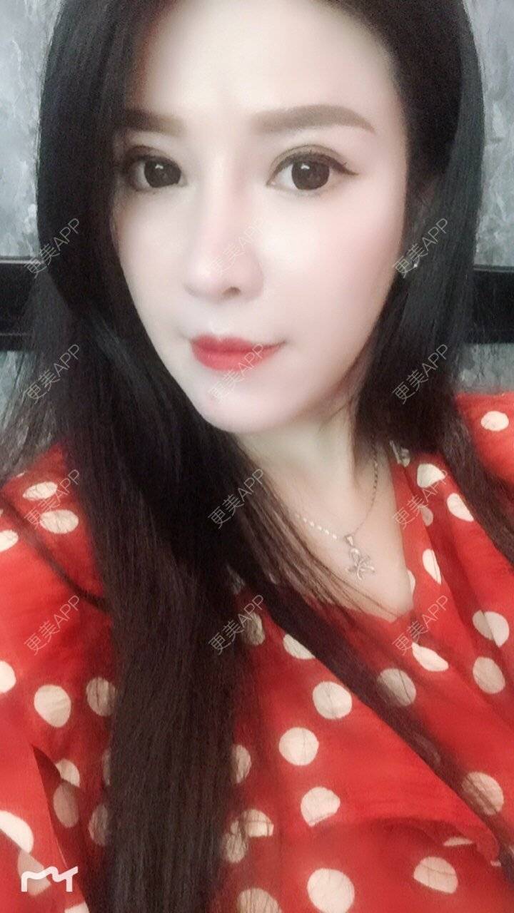 更美 - 甘思佳的热玛吉经验 | 北京 | 热玛吉