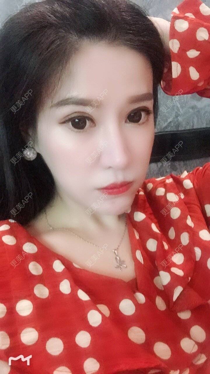更美 - 甘思佳的热玛吉经验 | 北京 | 热玛吉