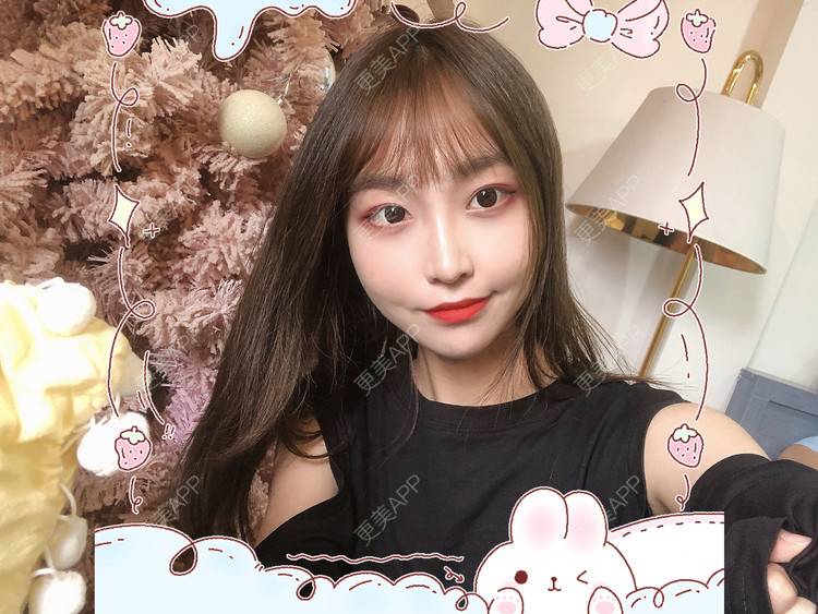 更美 - 更美用户Vb1ObdFyMB的自体脂肪隆鼻经验 | 自体脂肪隆鼻 | 无锡