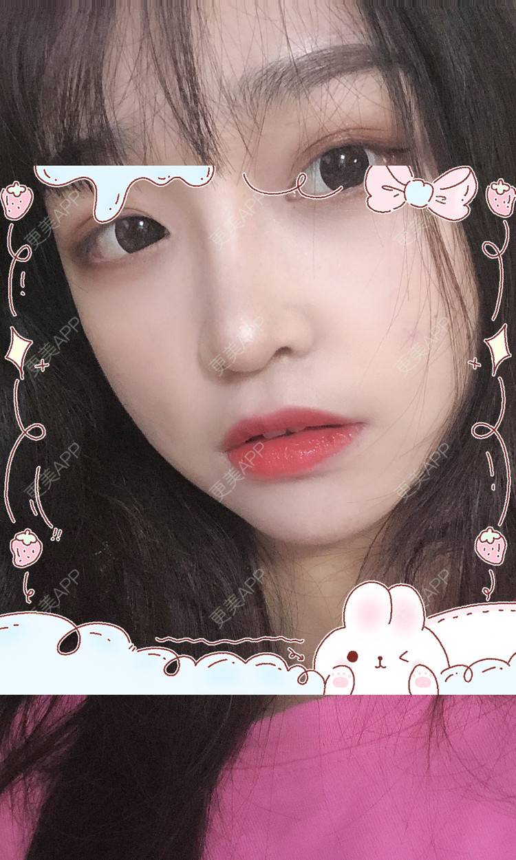 更美 - 更美用户Vb1ObdFyMB的自体脂肪隆鼻经验 | 自体脂肪隆鼻 | 无锡