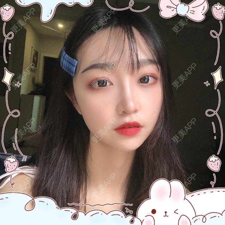 更美 - 更美用户Vb1ObdFyMB的自体脂肪隆鼻经验 | 自体脂肪隆鼻 | 无锡