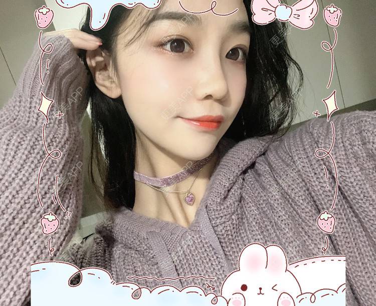 更美 - 更美用户Vb1ObdFyMB的自体脂肪隆鼻经验 | 自体脂肪隆鼻 | 无锡