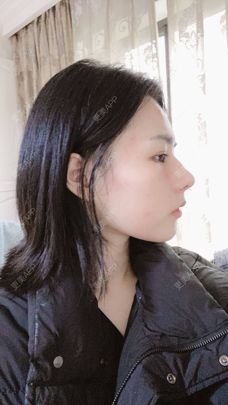 更美 - ヌ酷还可爱ˇ男的鼻部多项经验 | 鼻部多项 | 重庆