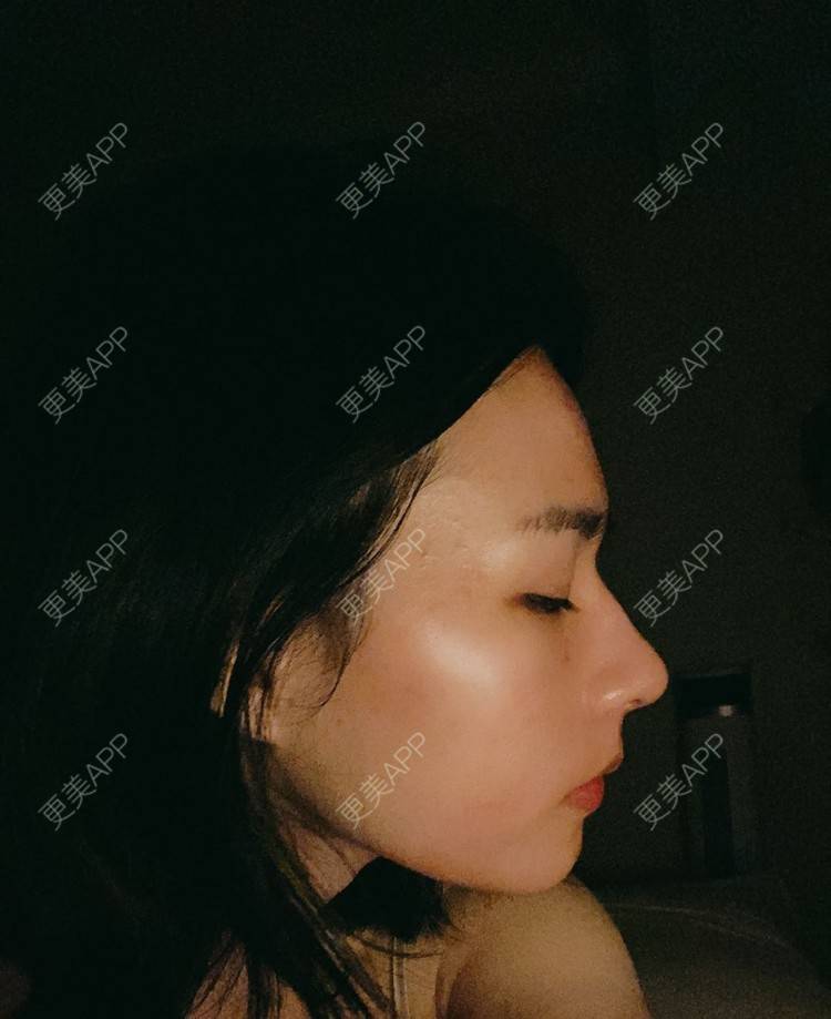 更美 - ヌ酷还可爱ˇ男的鼻部多项经验 | 鼻部多项 | 重庆