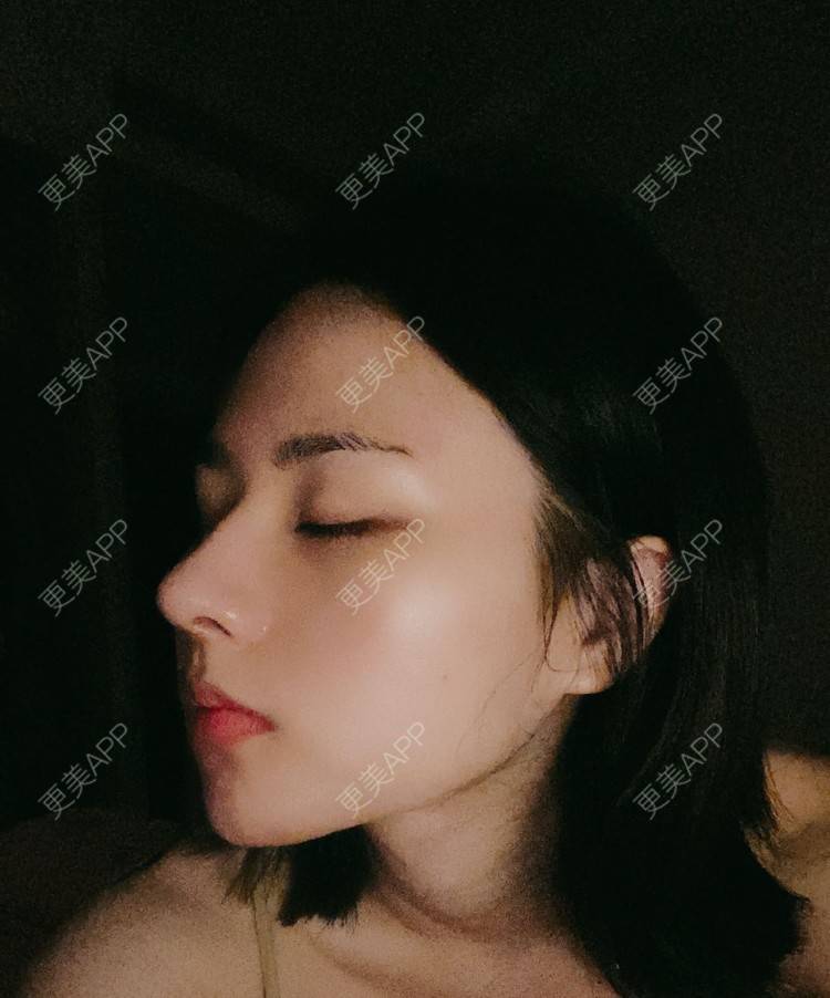 更美 - ヌ酷还可爱ˇ男的鼻部多项经验 | 鼻部多项 | 重庆