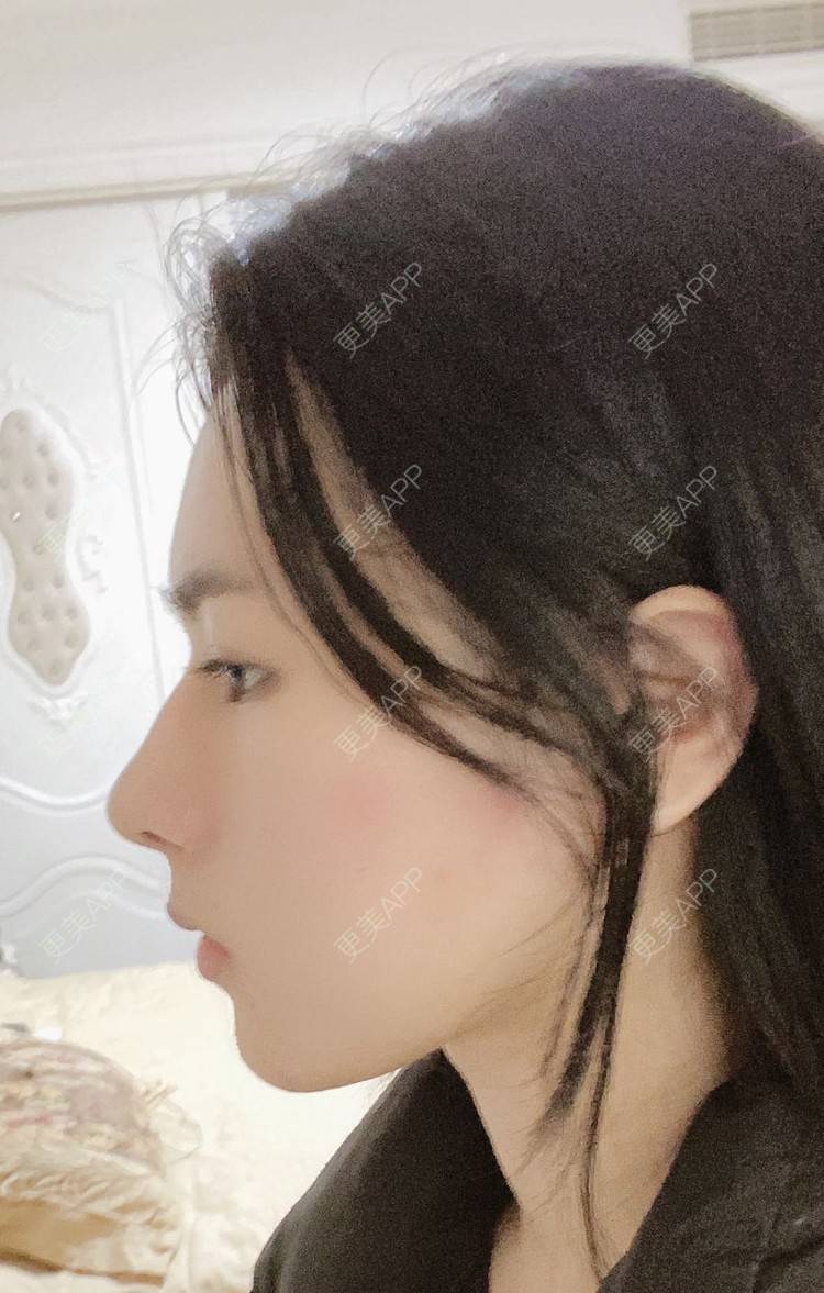 更美 - ヌ酷还可爱ˇ男的鼻部多项经验 | 鼻部多项 | 重庆