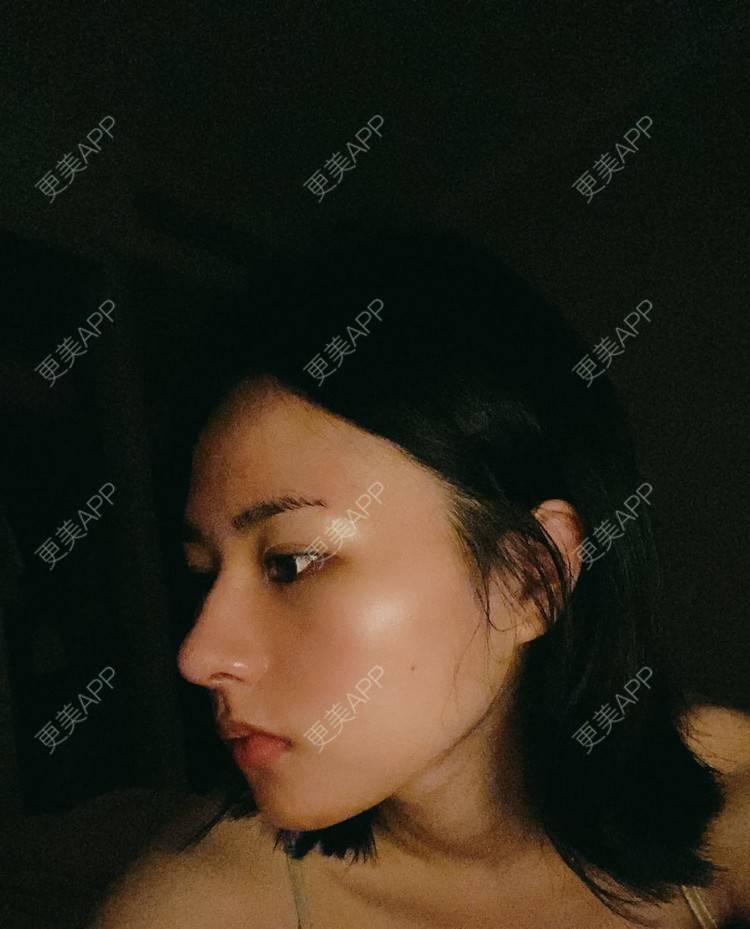 更美 - ヌ酷还可爱ˇ男的鼻部多项经验 | 鼻部多项 | 重庆