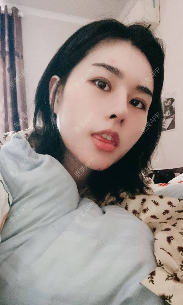 更美 - ヌ酷还可爱ˇ男的鼻部多项经验 | 鼻部多项 | 重庆