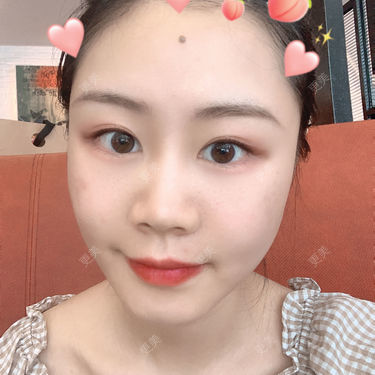 喵咩咩胀