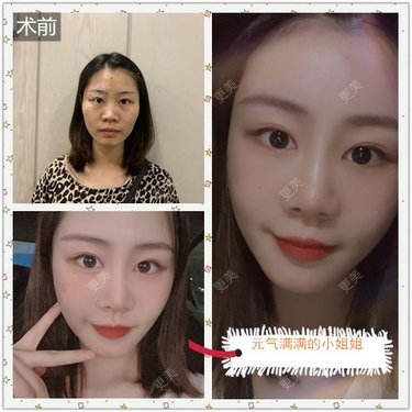喵咩咩胀