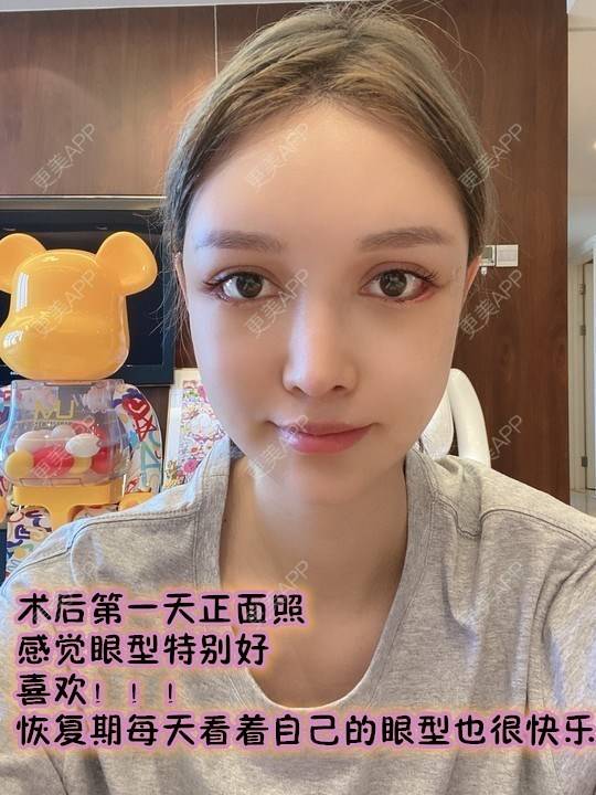 更美 - abby吴晓辰的眼睑下至日记 | 眼睑下至 | 北京 | 视频日记