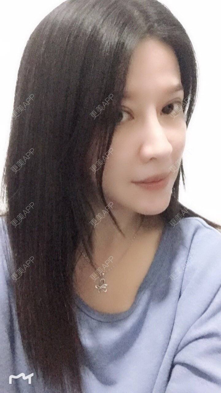 更美 - 甘思佳的热玛吉经验 | 北京 | 热玛吉