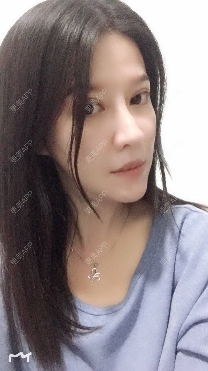 更美 - 甘思佳的热玛吉经验 | 北京 | 热玛吉
