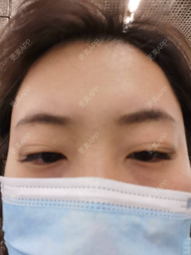 更美 - 更美用户nuH8tXfe4X的孕睫术经验 | 上海 | 孕睫术