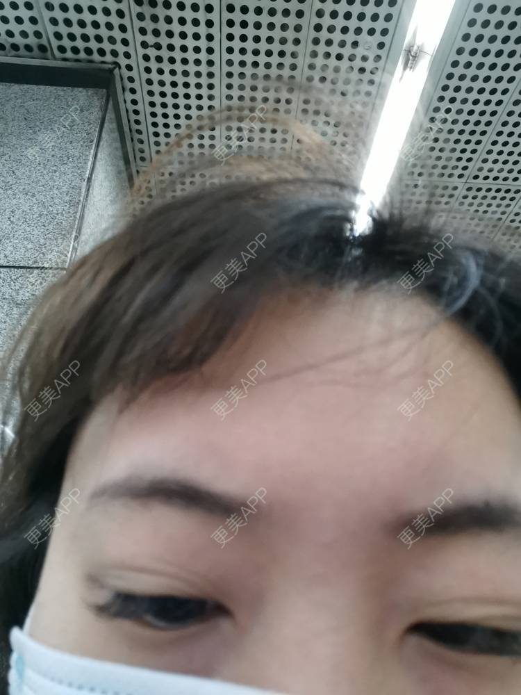 更美 - 更美用户nuH8tXfe4X的孕睫术经验 | 上海 | 孕睫术