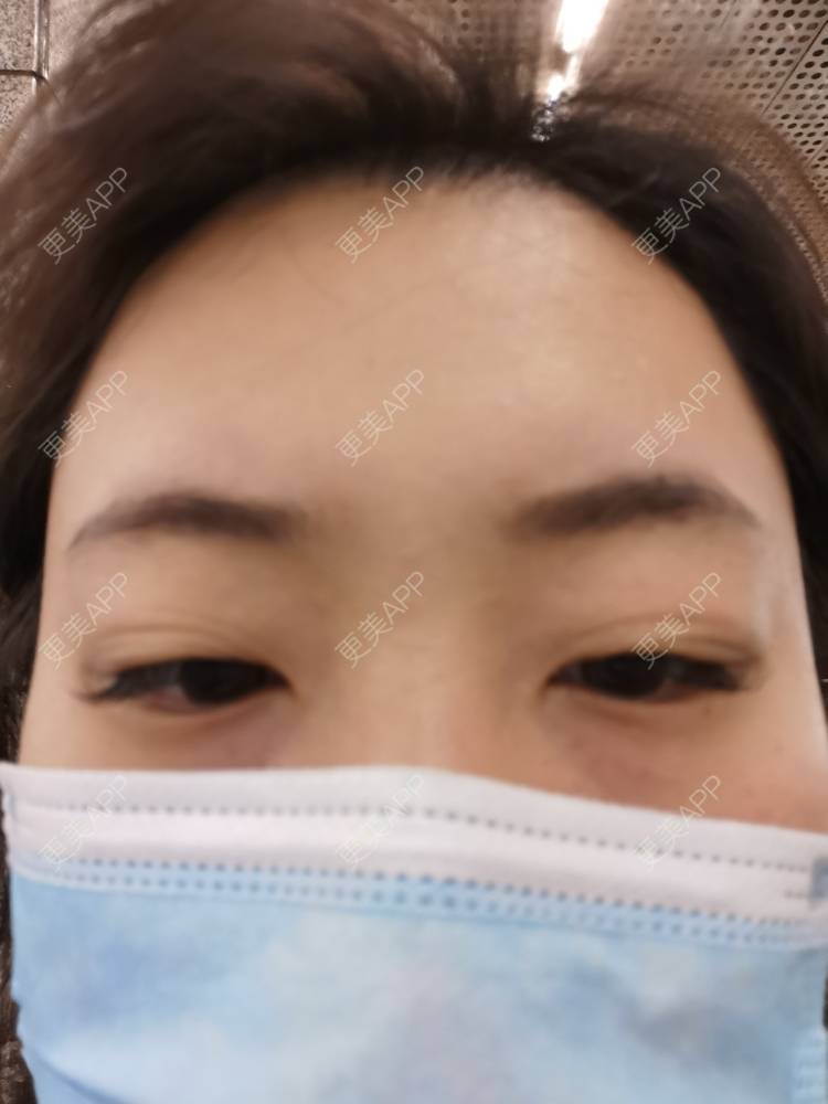 更美 - 更美用户nuH8tXfe4X的孕睫术经验 | 上海 | 孕睫术