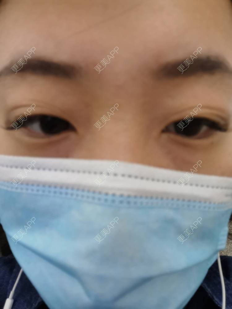 更美 - 更美用户nuH8tXfe4X的孕睫术经验 | 上海 | 孕睫术