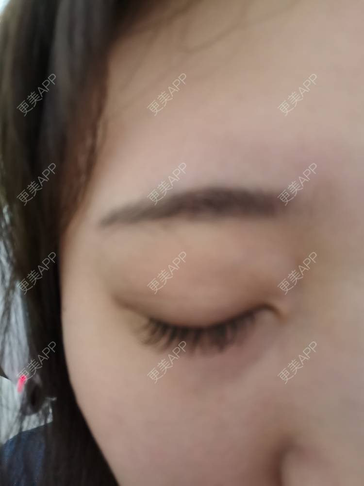 更美 - 更美用户nuH8tXfe4X的孕睫术经验 | 上海 | 孕睫术