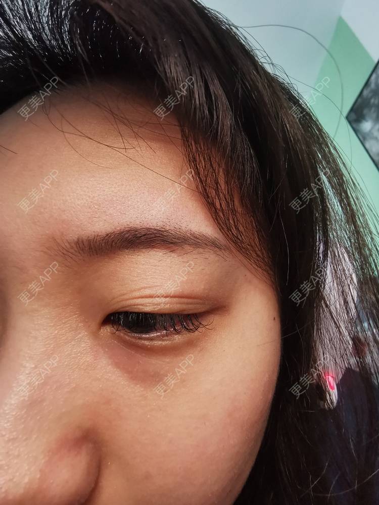 更美 - 更美用户nuH8tXfe4X的孕睫术经验 | 上海 | 孕睫术