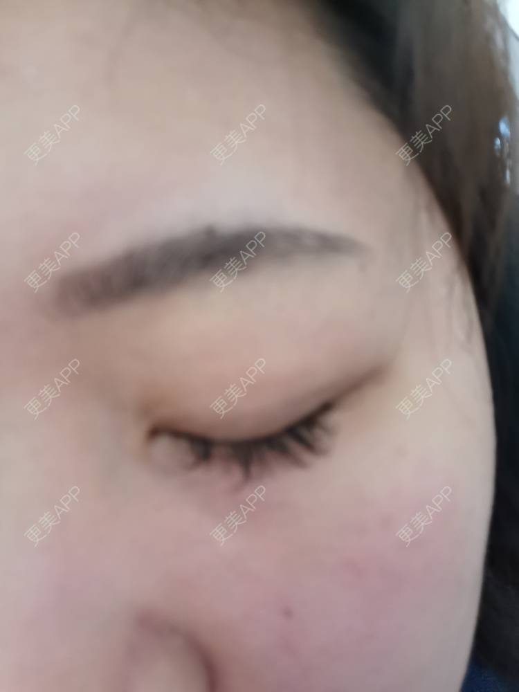 更美 - 更美用户nuH8tXfe4X的孕睫术经验 | 上海 | 孕睫术