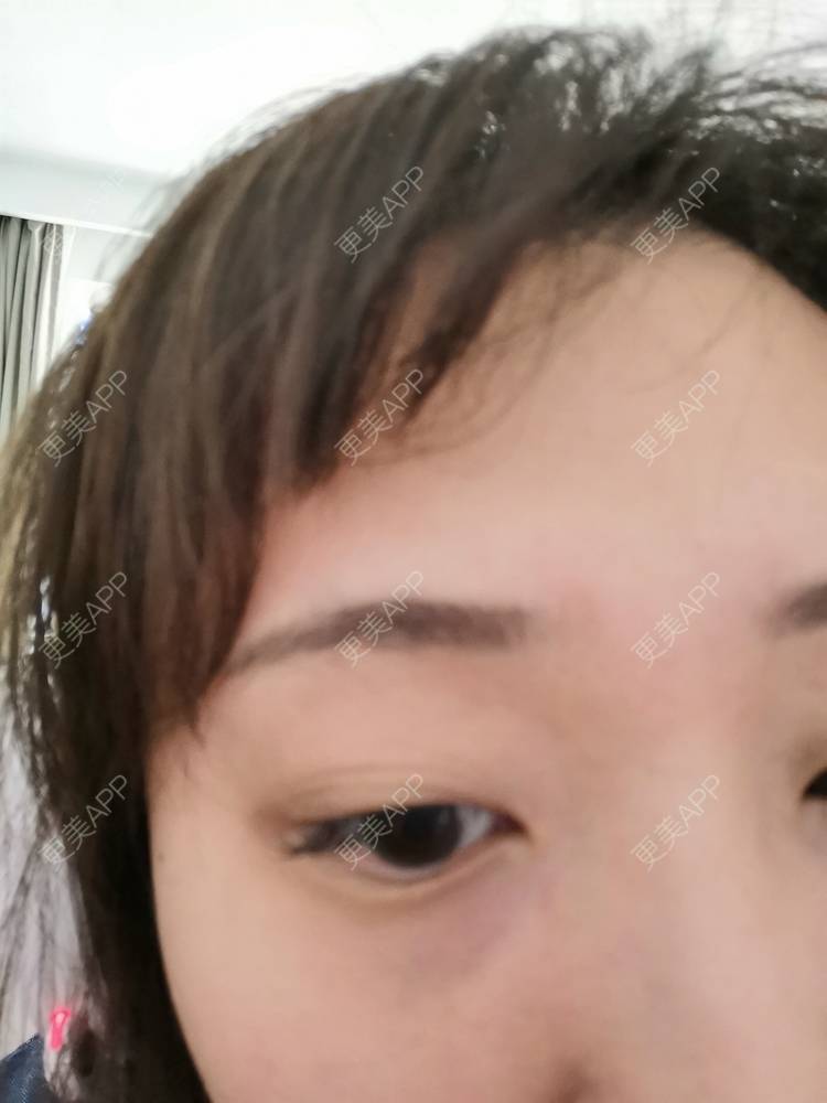 更美 - 更美用户nuH8tXfe4X的孕睫术经验 | 上海 | 孕睫术