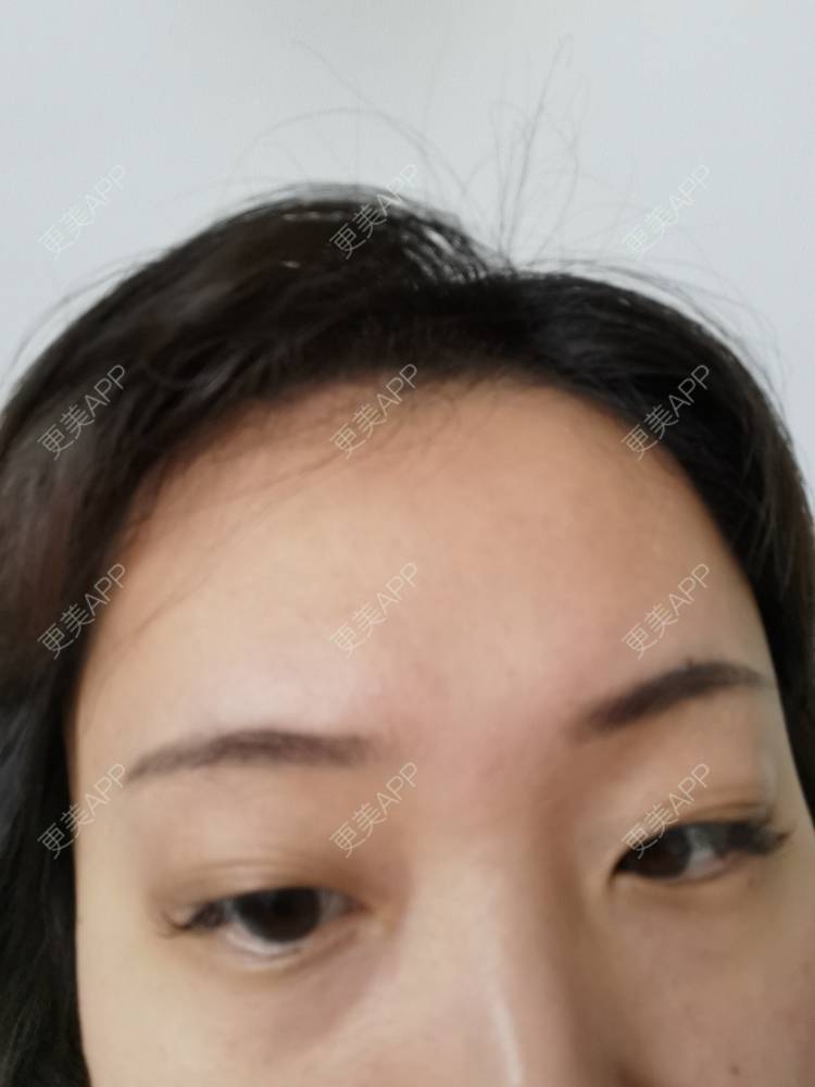 更美 - 更美用户nuH8tXfe4X的孕睫术经验 | 上海 | 孕睫术