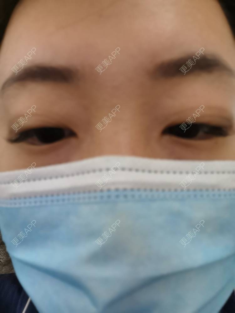 更美 - 更美用户nuH8tXfe4X的孕睫术经验 | 上海 | 孕睫术