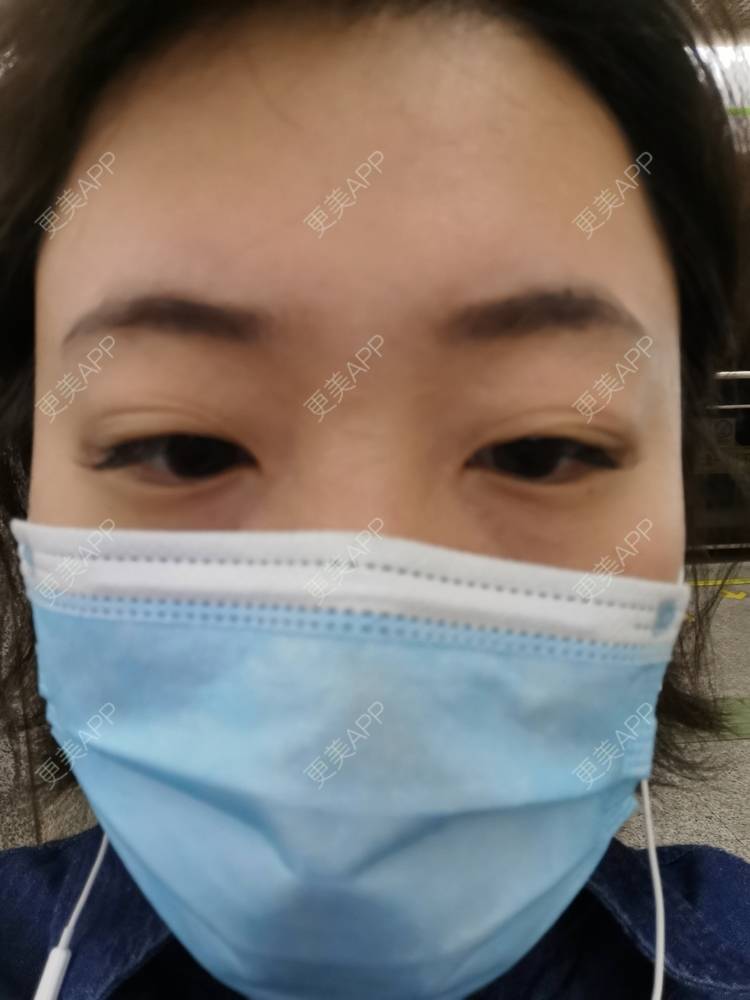 更美 - 更美用户nuH8tXfe4X的孕睫术经验 | 上海 | 孕睫术
