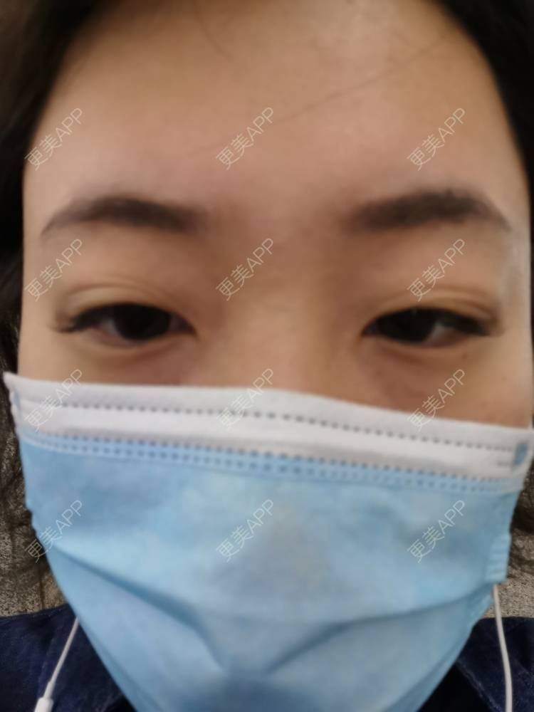更美 - 更美用户nuH8tXfe4X的孕睫术经验 | 上海 | 孕睫术