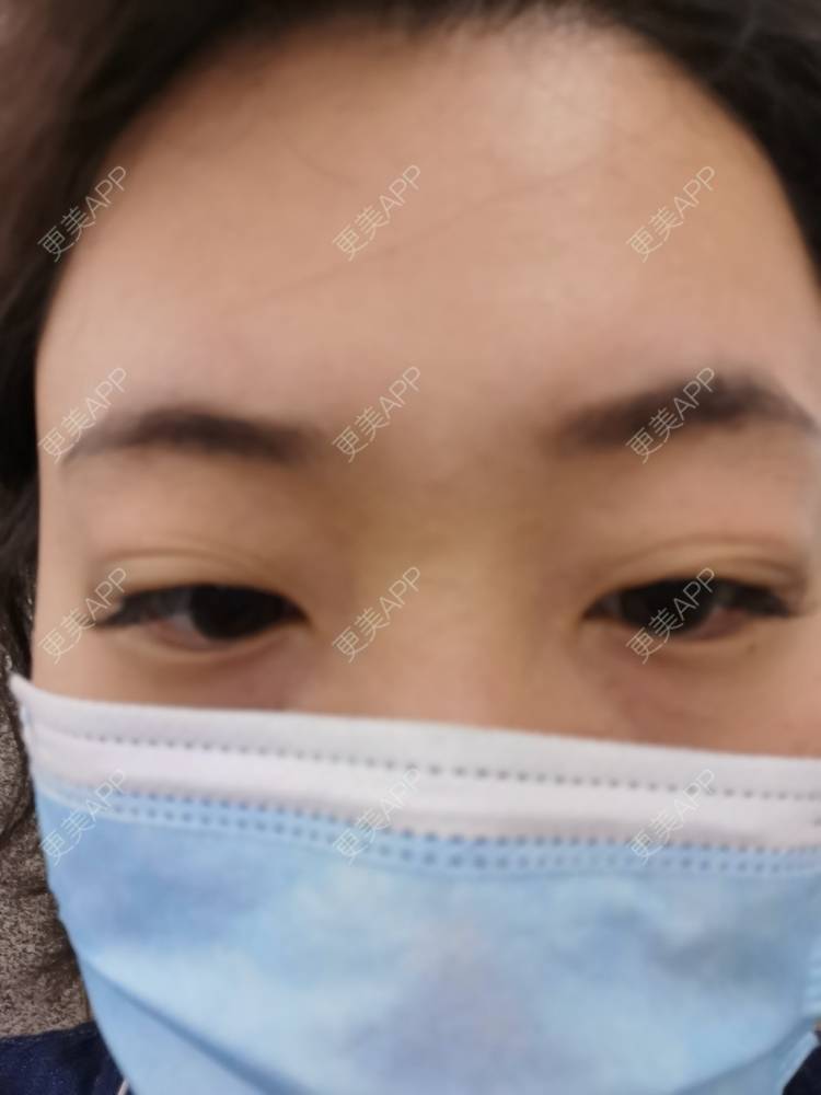 更美 - 更美用户nuH8tXfe4X的孕睫术经验 | 上海 | 孕睫术