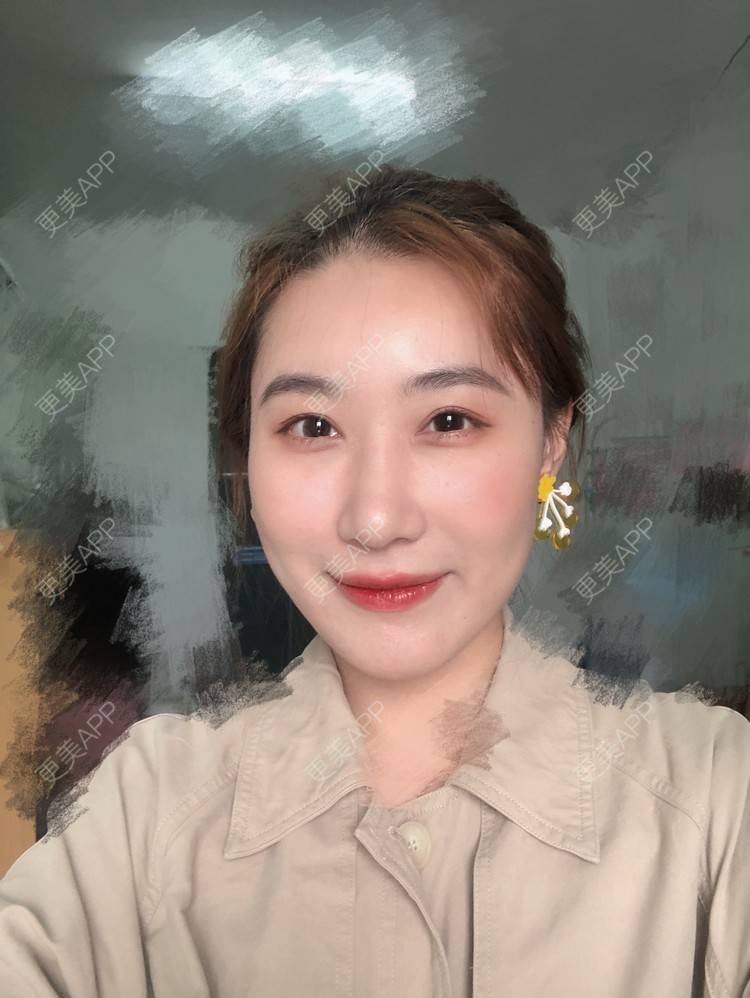 更美 - 会魔法的小仙女肛的鼻部多项经验 | 鼻部多项 | 河源
