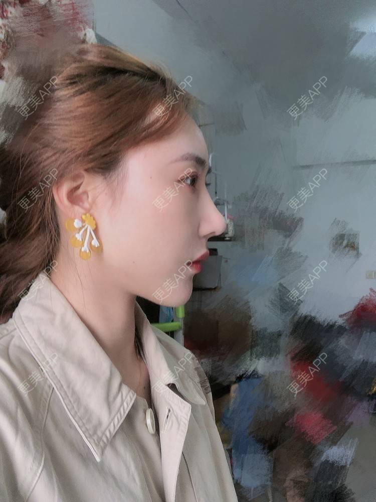 更美 - 会魔法的小仙女肛的鼻部多项经验 | 鼻部多项 | 河源