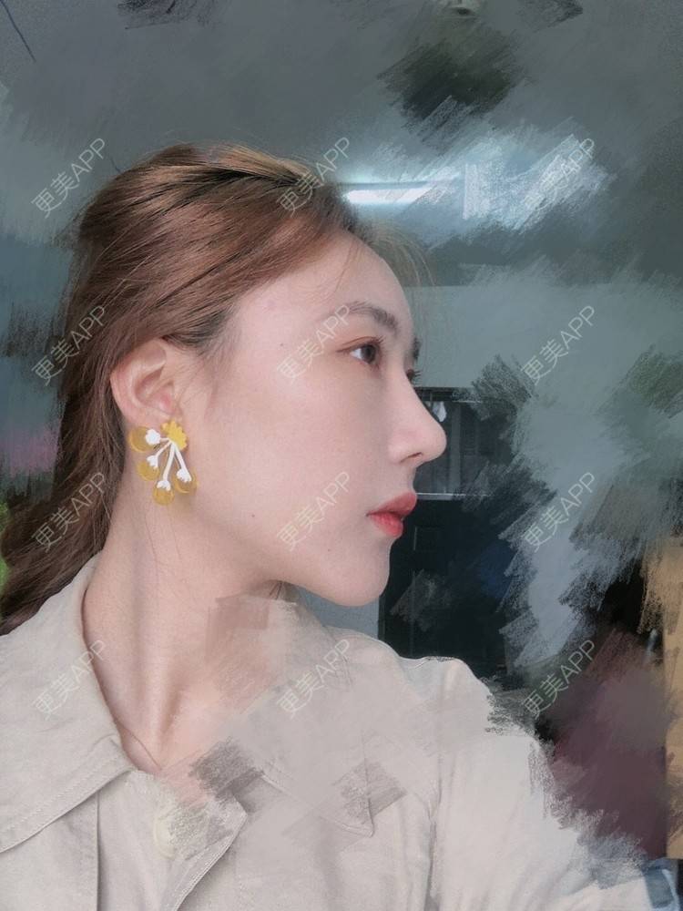 更美 - 会魔法的小仙女肛的鼻部多项经验 | 鼻部多项 | 河源