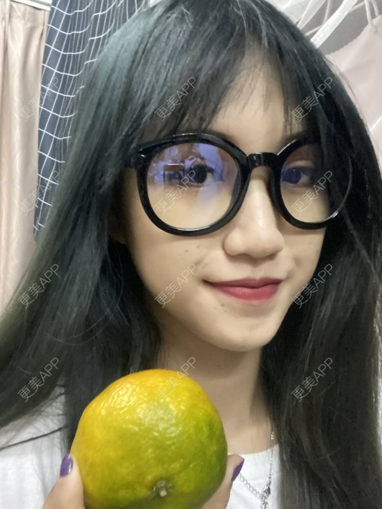 更美 - 更美用户adRwJmFyqQ的除皱瘦脸经验 | 除皱瘦脸 | 深圳