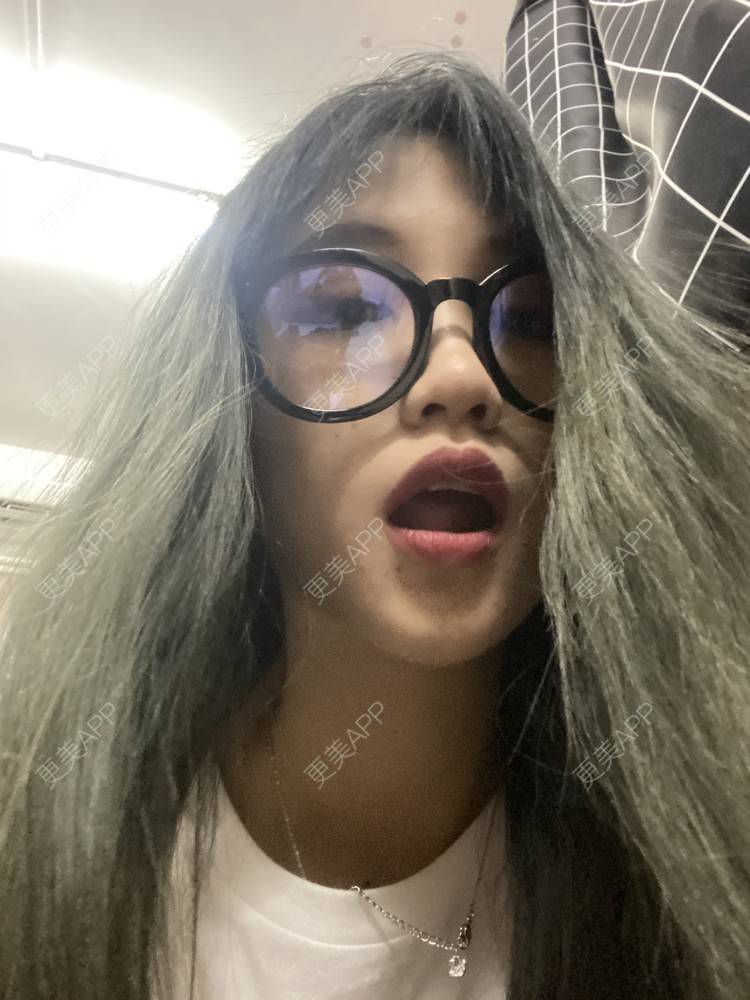 更美 - 更美用户adRwJmFyqQ的除皱瘦脸经验 | 除皱瘦脸 | 深圳