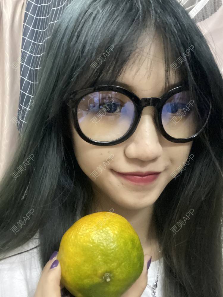 更美 - 更美用户adRwJmFyqQ的除皱瘦脸经验 | 除皱瘦脸 | 深圳