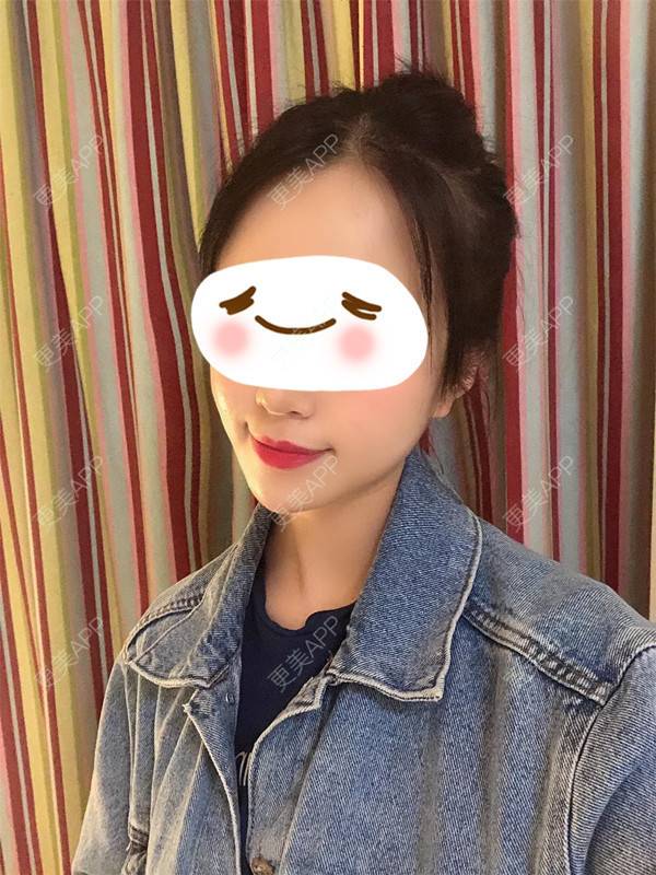 更美 - 更美用户giwbaHYoBg的M唇成形经验 | M唇成形