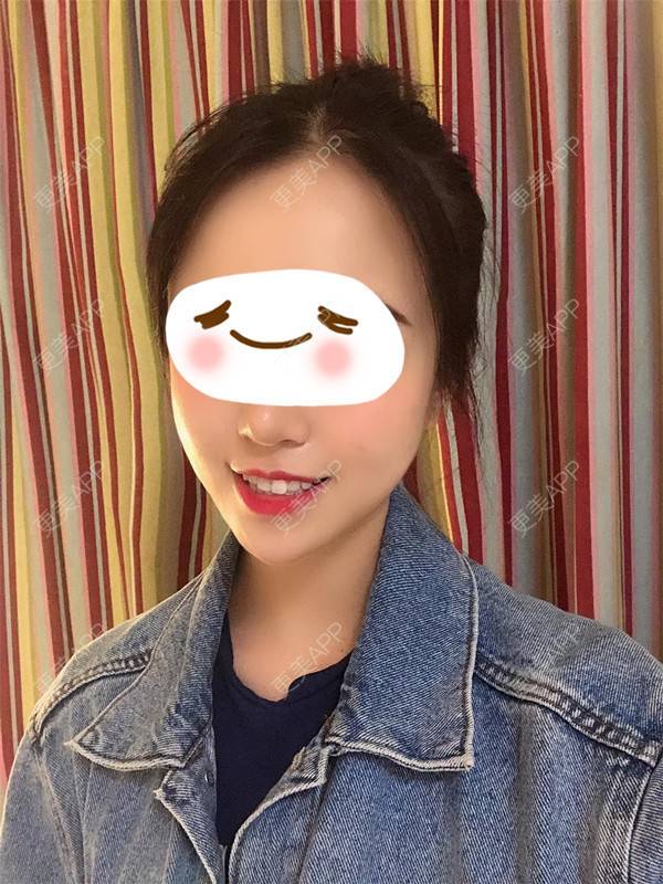 更美 - 更美用户giwbaHYoBg的M唇成形经验 | M唇成形