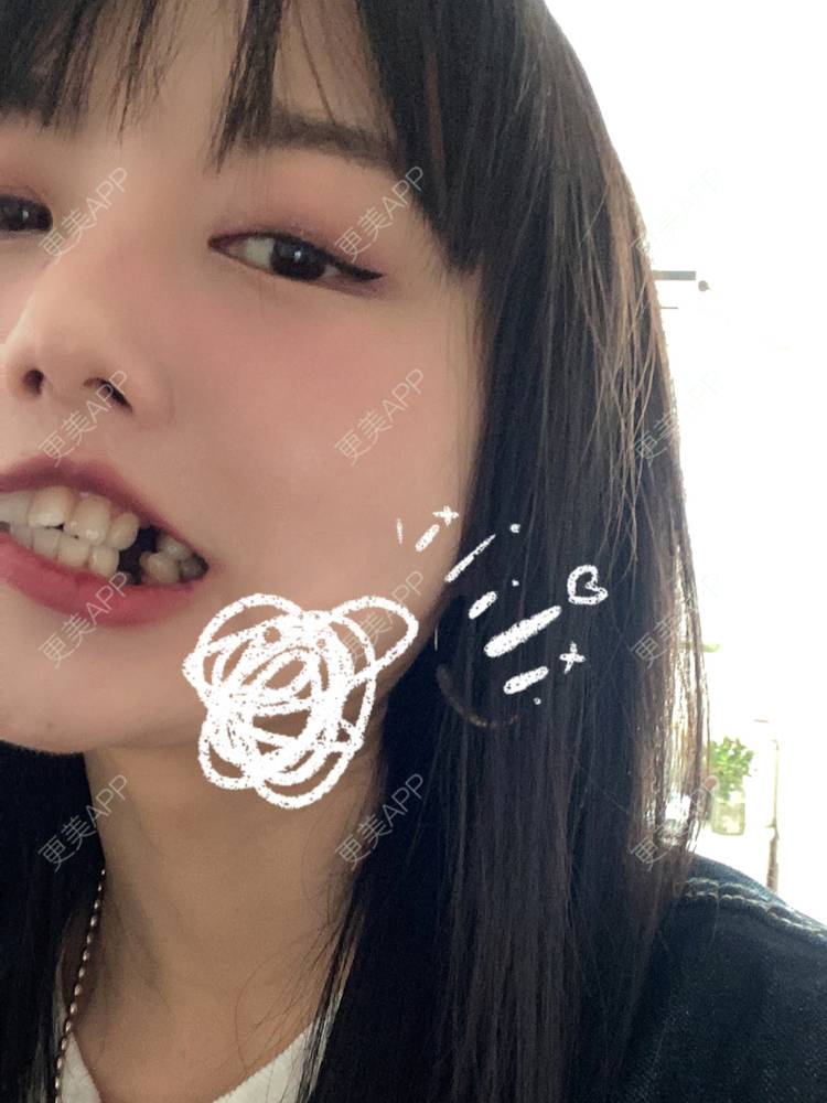 更美 - 麦事浅唱幸福的拔龋齿经验 | 拔智齿 | 拔龋齿