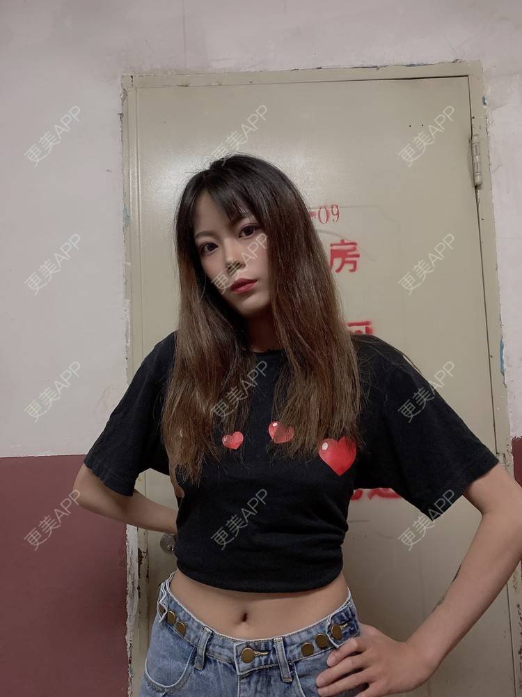 更美 - 一曲钟叹涤的产后修复经验 | 产后塑形 | 综合淡疤 | 产后修复 | 成都