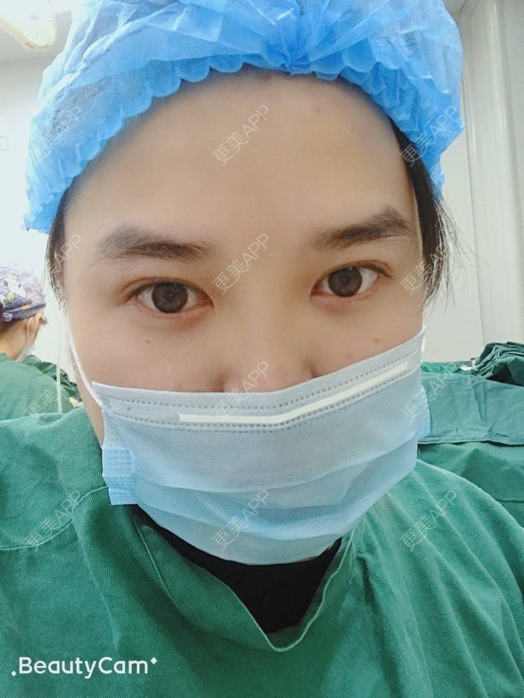 更美 - 爱分享的橙子君的全切双眼皮经验 | 全切双眼皮 | 人工骨隆鼻 | 吸脂瘦脸 | 杭州