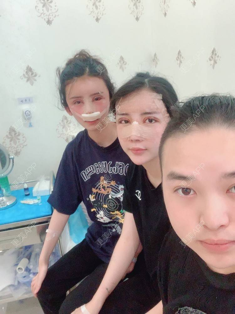 更美 - 爱分享的橙子君的全切双眼皮经验 | 全切双眼皮 | 人工骨隆鼻 | 吸脂瘦脸 | 杭州