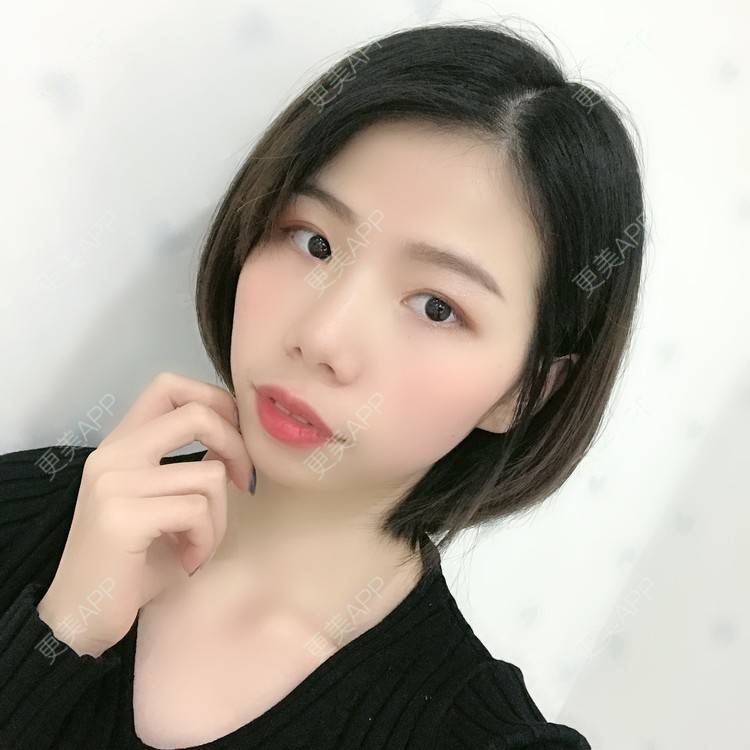 更美 - 更美用户XALPc5RVJ3的热玛吉经验 | 广州 | 热玛吉