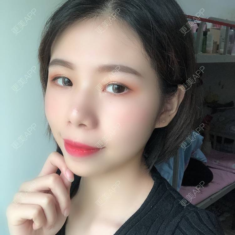 更美 - 更美用户XALPc5RVJ3的热玛吉经验 | 广州 | 热玛吉