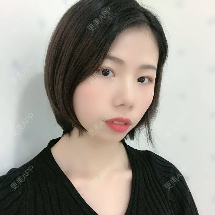 更美 - 更美用户XALPc5RVJ3的热玛吉经验 | 广州 | 热玛吉