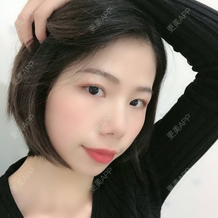 更美 - 更美用户XALPc5RVJ3的热玛吉经验 | 广州 | 热玛吉