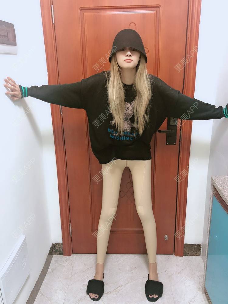 更美用户d206ghyixx的吸脂瘦大腿日记