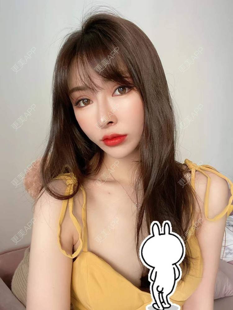 更美 - 橘子汽水789的肋软骨隆鼻经验 | 肋软骨隆鼻 | 广州