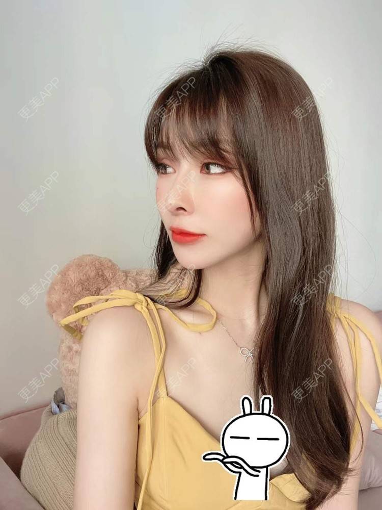更美 - 橘子汽水789的肋软骨隆鼻经验 | 肋软骨隆鼻 | 广州